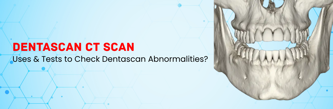 Dentascan CT Scan: What are the Uses